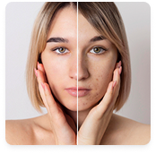 Skin consult